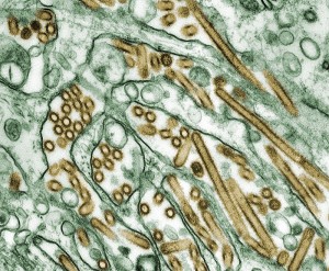 800px-Colorized_transmission_electron_micrograph_of_Avian_influenza_A_H5N1_viruses